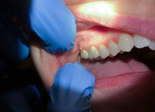 Best Cracked Tooth Emergency Dentist  in North Bennington, VT